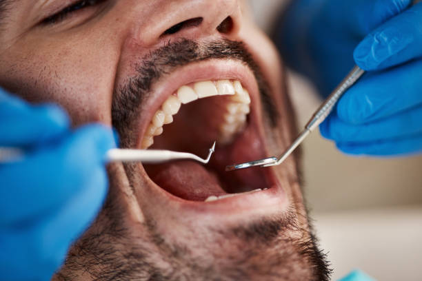 Best Cracked Tooth Emergency Dentist  in Powell, WY
